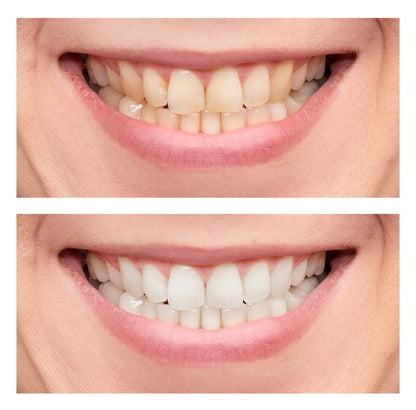 Bandes Blanchissantes FlashSmile